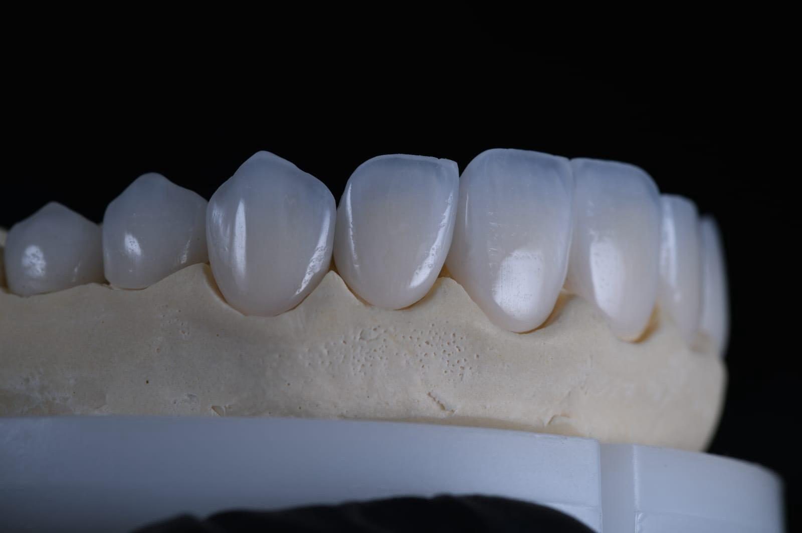 Dental Clinic Herastrau – Top Aesthetic Dentistry for Smiles from Around the World