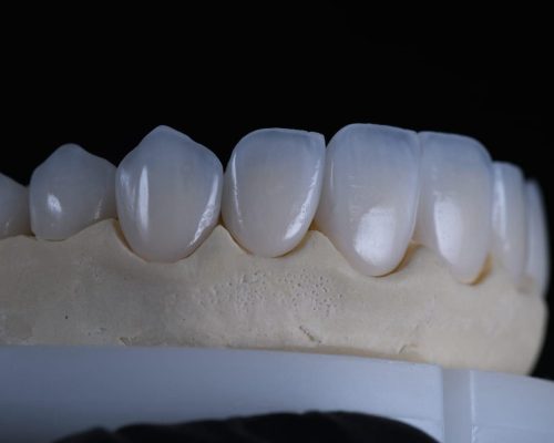 Dental Clinic Herastrau – Top Aesthetic Dentistry for Smiles from Around the World
